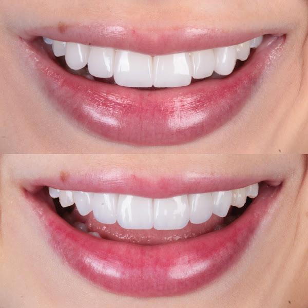 Foto 2 de Clínica Odonto Queiroz