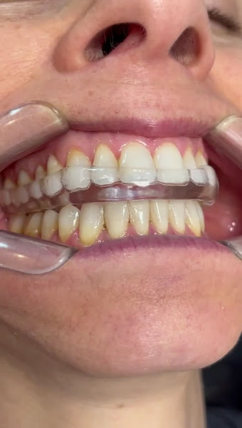 Foto 4 de Clínica Odonto Queiroz