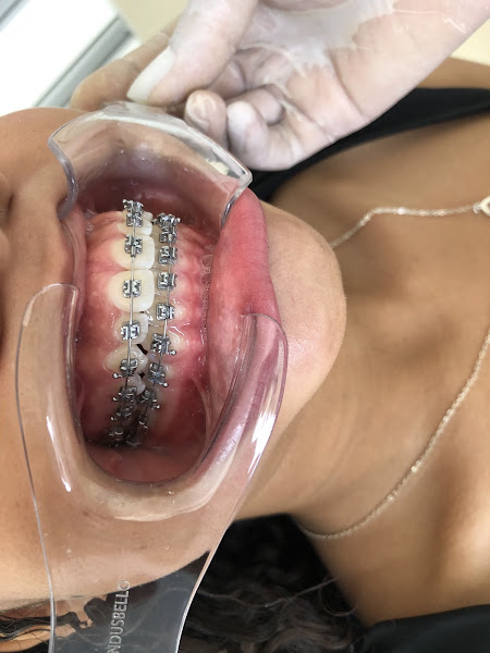 Foto 3 de Clínica Odonto Riso - Dra Regislene Silva - Itapuã, Fazendinha.