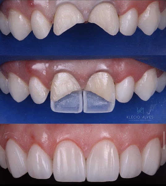 Foto 3 de Clínica Odonto Up - Implantes, Ortodontia, Harmonização Facial, Odontopediatria, Clínico Geral e Exames.