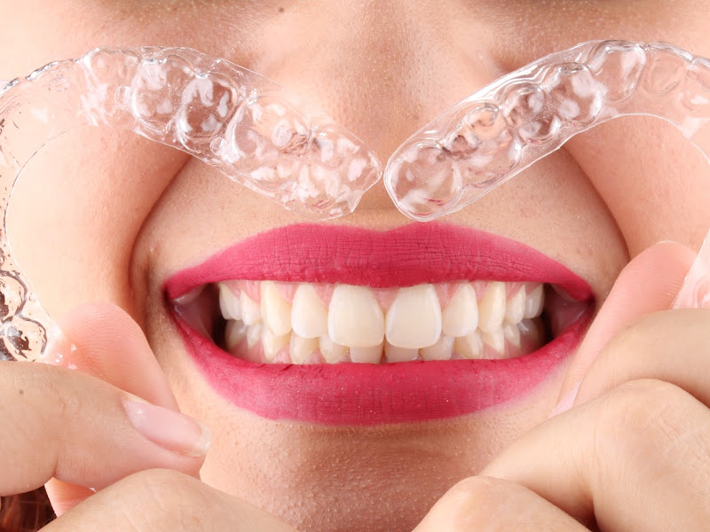 Foto 3 de Clínica Odontoface