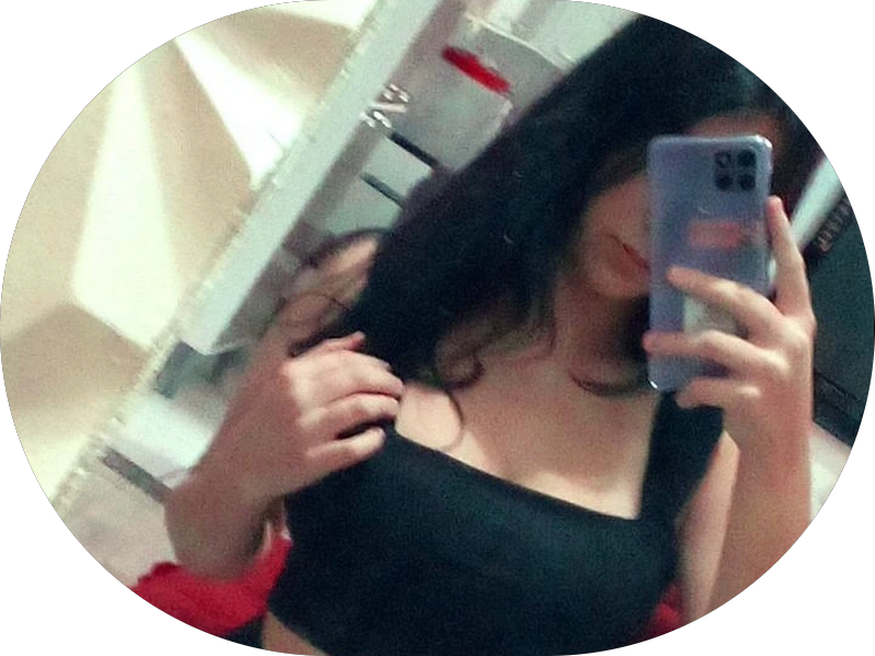 Foto 4 de Clínica Odontoguimaraes / Harmonizações Faciais / Preenchimentos labiais / Facetas em Resina