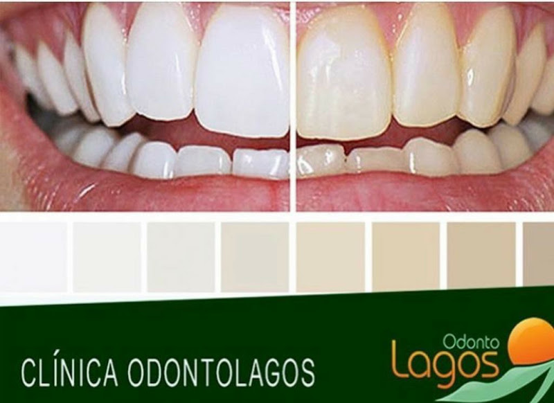 Foto 2 de Clínica OdontoLagos Rio das Ostras