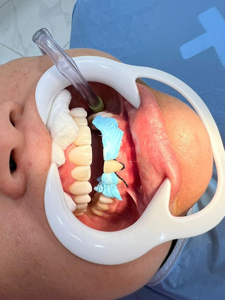 Foto 3 de Clinica Odontoleste