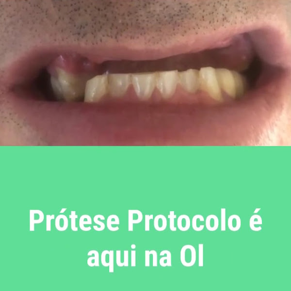 Foto 5 de Clínica Odontologia Ioselli | Dra. Luciana Ioselli e Dr. Carlos Barros