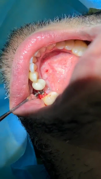 Foto 4 de Clínica Odontológica AFA - Dentista Recanto das Emas