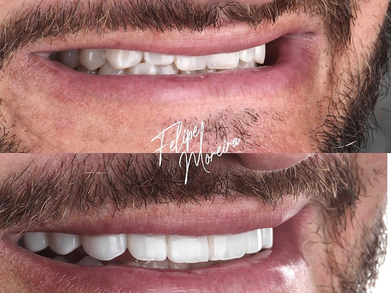 Foto 7 de Clínica Odontológica Alife - Praia da Costa em Vila Velha