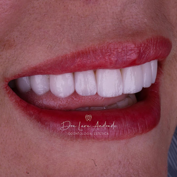 Foto 3 de Clínica Odontológica Alta Performance Dra Lara Andrade
