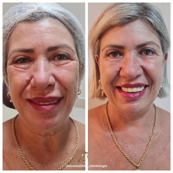 Foto 3 de Clínica Odontológica Alves Batista - Dentista