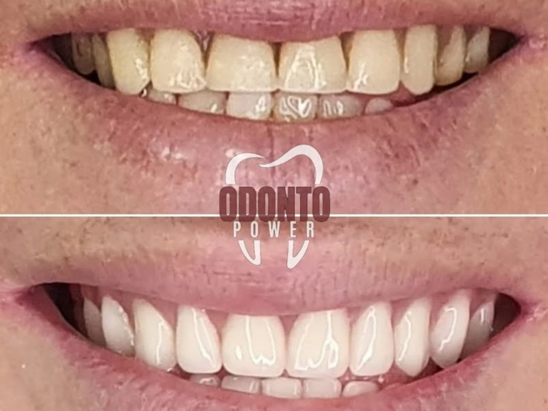 Foto 7 de Clínica Odontológica Atitud Odonto Guarulhos