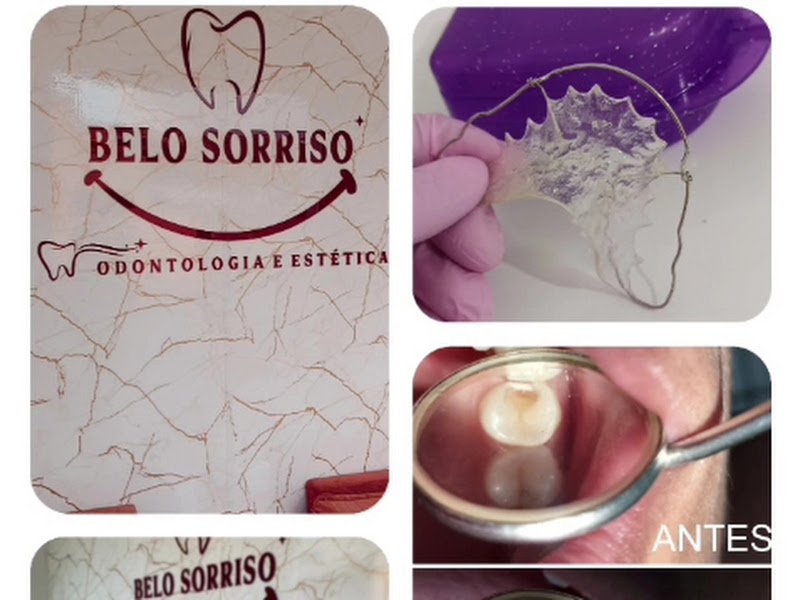 Foto 2 de Clínica Odontológica Belo Sorriso