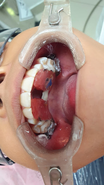 Foto 2 de Clínica Odontológica de Rio das Ostras