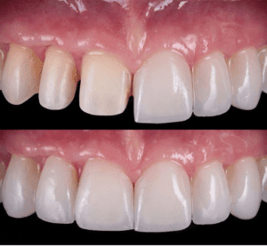 Foto 5 de Clínica Odontológica Dental Santé