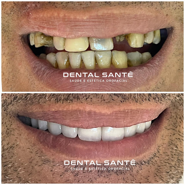 Foto 6 de Clínica Odontológica Dental Santé