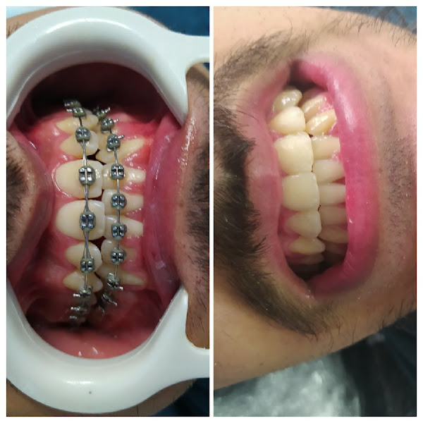 Foto 3 de Clínica Odontológica Dente Feliz