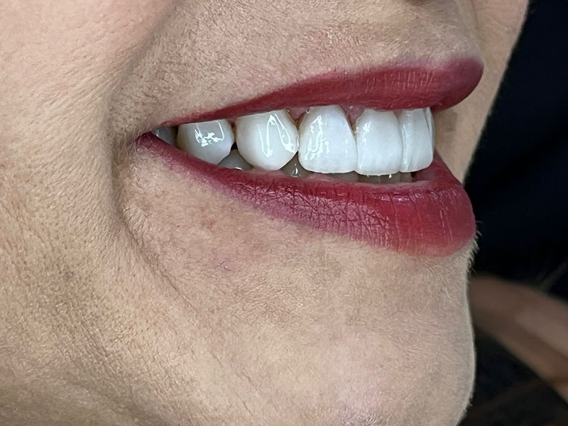 Foto 2 de Clínica Odontológica DENTEBRAS Teresina 13 De Maio