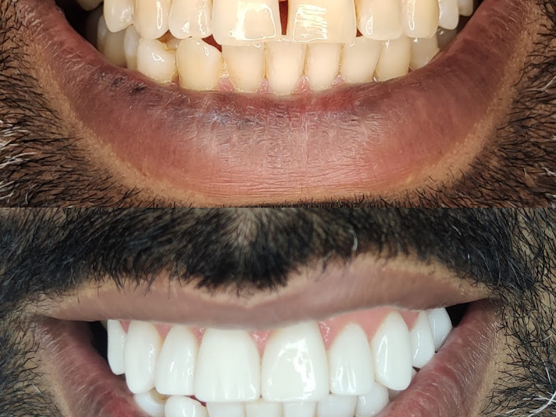 Foto 3 de Clínica Odontológica | Dentista Mooca/Brás | Dra. Tainá Azevedo
