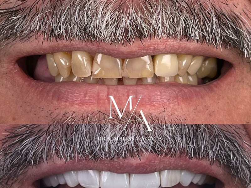 Foto 7 de Clínica Odontólogica-Dents Clin-FÁBRICA DE SORRISOS