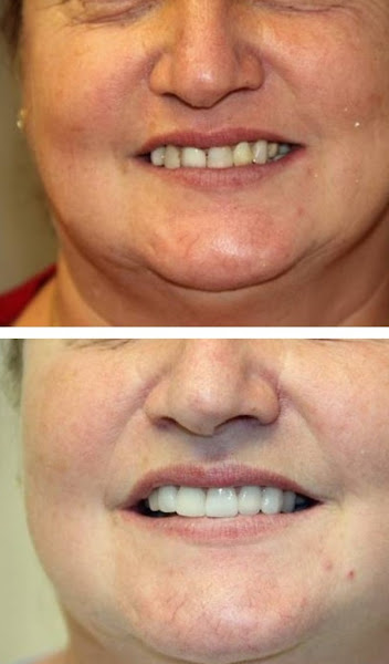 Foto 3 de Clínica Odontológica Denvida | Brusque | Implantes Dentários | Lentes em Resina | Dentista