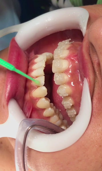 Foto 3 de Clínica Odontológica DNTBRAS Belém Guamá