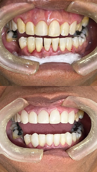 Foto 4 de Clínica Odontológica DNTBRAS Campina Grande Centro