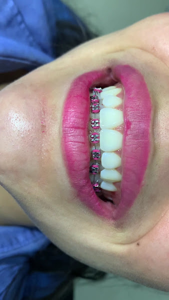 Foto 3 de Clínica Odontológica DNTBRAS Macapá Buritizal