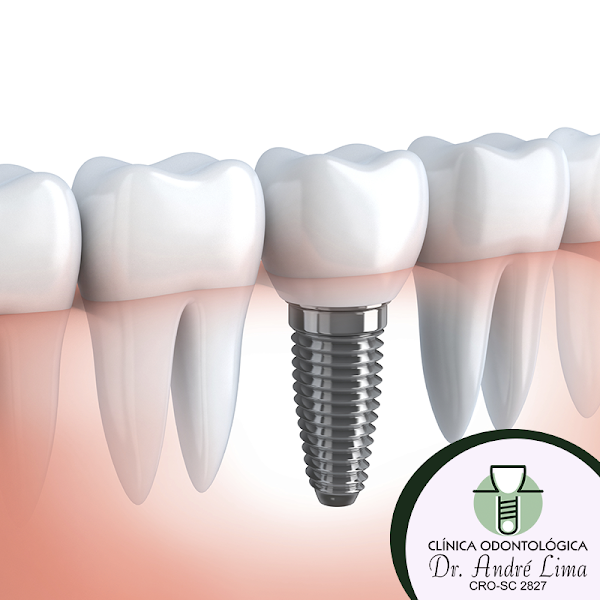 Foto 3 de Clínica Odontológica Dr. André Lima | Criciúma - SC
