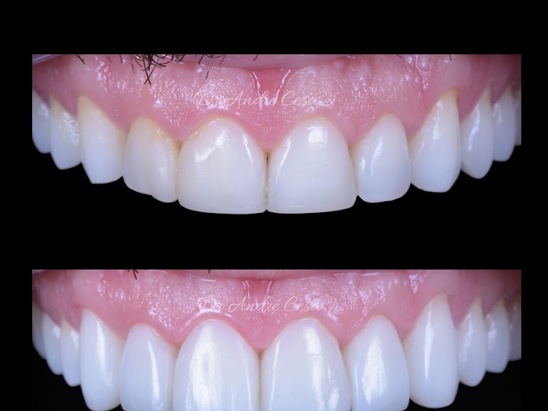 Foto 9 de Clínica Odontológica Dr. André Lima | Criciúma - SC