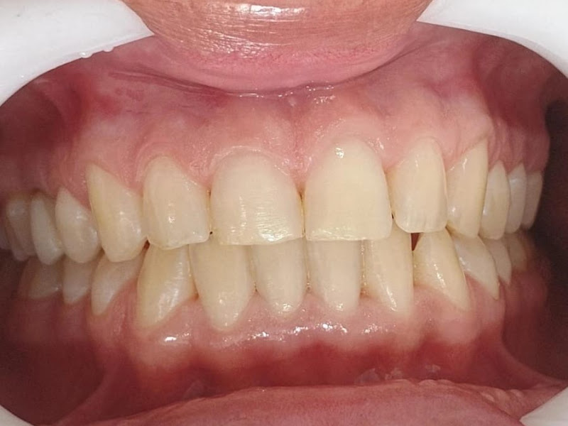 Foto 9 de Clínica Odontológica Dr. Cleiton Esteves