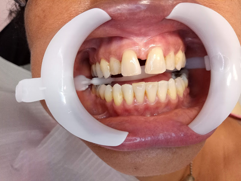 Foto 3 de Clínica Odontológica Dr Ely Botelho