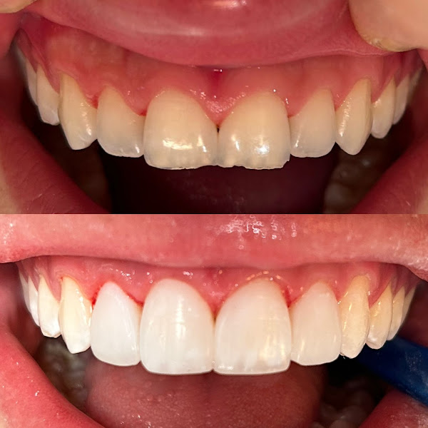 Foto 2 de Clínica Odontológica - Dr. Felipe Oliveira | Dentista em Canoas