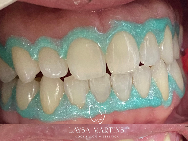 Foto 7 de Clínica Odontológica Dr Leonardo Costa