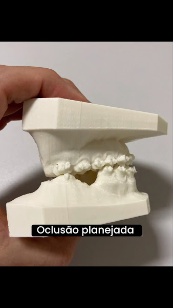 Foto 4 de Clínica Odontológica Dr. Marcus Brêda em Jatiúca Maceió, Plano De Saúde, Extração do Siso, Implante Dentário, Cirurgia