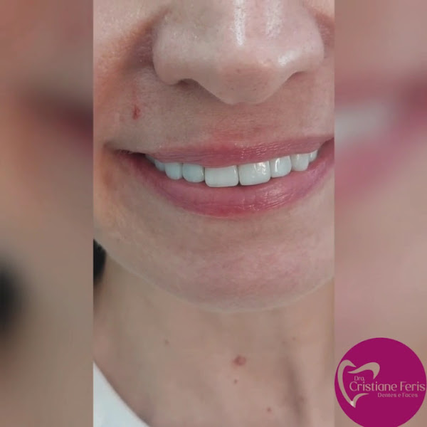 Foto 3 de Clínica Odontológica Dra. Cristiane Feris – Estética e Reabilitação Oral em Campinas