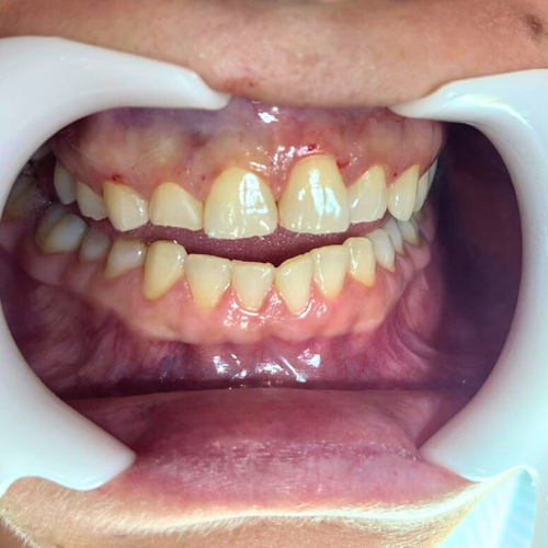 Foto 2 de Clínica Odontológica Dra.Giulia Sousa - Odontologia Humanizada e Estética
