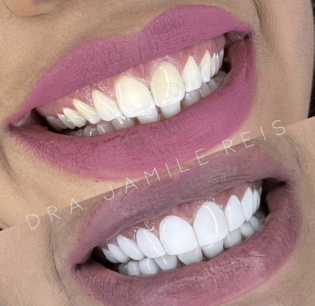 Foto 3 de Clínica Odontológica Dra. Jamile Reis