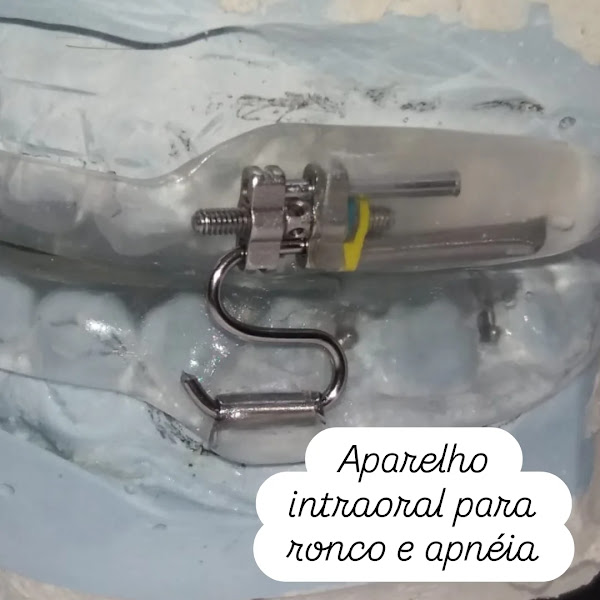 Foto 2 de Clínica Odontológica Dra. Jin Vasques | Implantes e Estética
