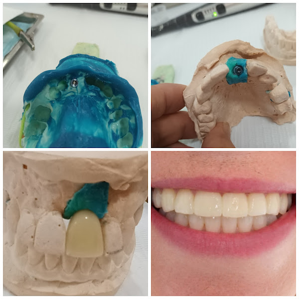 Foto 3 de Clínica Odontológica Dra. Jin Vasques | Implantes e Estética na Paulista