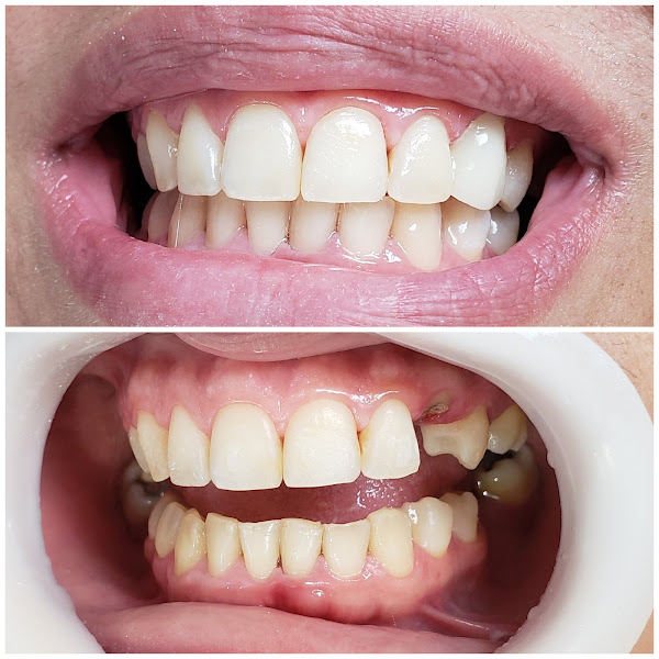 Foto 3 de Clínica Odontológica - Dra. Kátia Rodrigues Bizerra