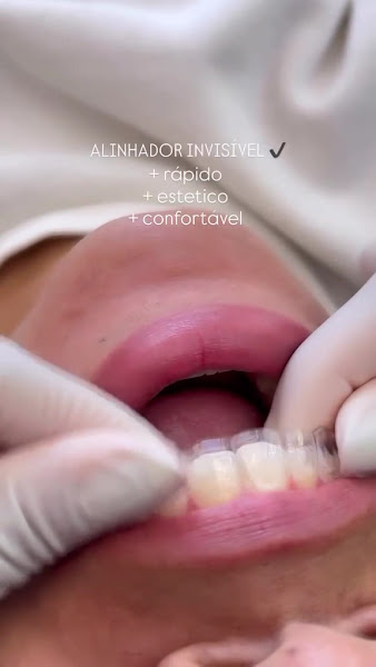 Foto 2 de Clínica Odontológica Dra Leisa Navarro