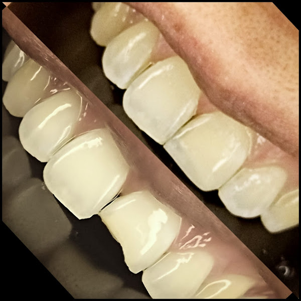 Foto 3 de Clinica odontológica Dra Marcia Garcia - Dentista, implante dentário, clareamentos dentário, lentes de contato .