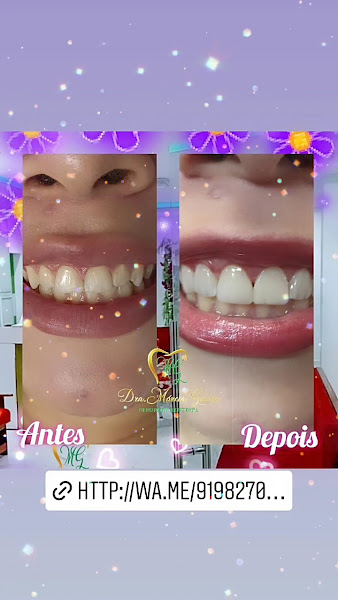 Foto 4 de Clinica odontológica Dra Marcia Garcia - Dentista, implante dentário, clareamentos dentário, lentes de contato .