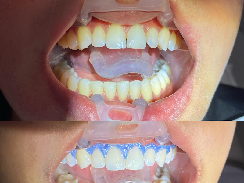 Foto 6 de Cliníca odontológica-Dra Marina Oliveira