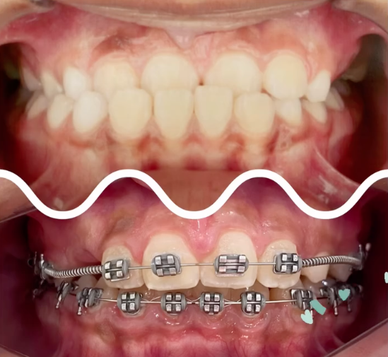 Foto 4 de Clínica Odontológica Dra. Michele Pombo