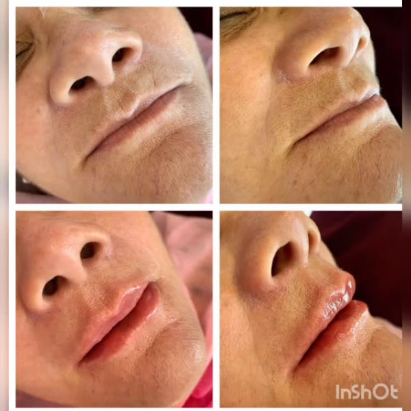 Foto 3 de Clínica Odontológica Dra Nathalia Velloso