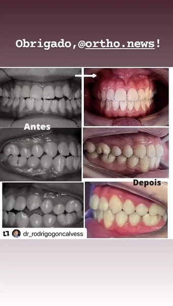 Foto 4 de Clínica Odontológica Duazzi Odontologia