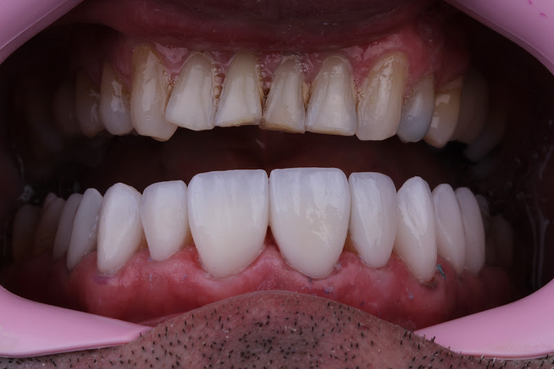 Foto 2 de Clinica odontológica Endoimplant