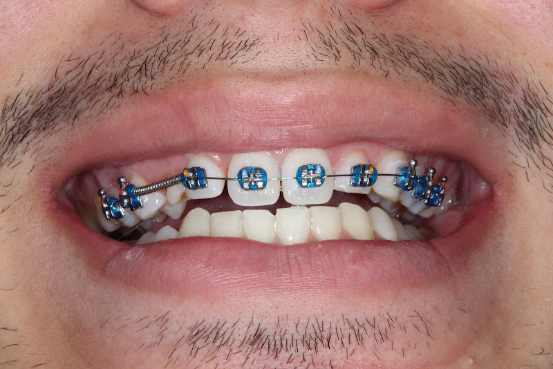 Foto 3 de Clinica odontológica Endoimplant