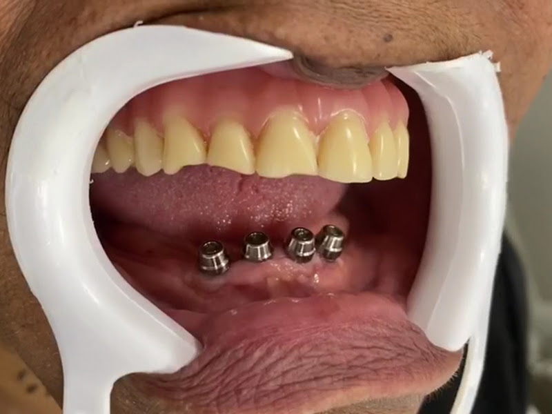 Foto 7 de Clínica Odontológica Espaço Sorriso