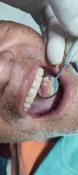 Foto 3 de Clínica Odontológica especializada Moura Viana